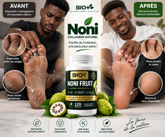 Noni Bio 4000 mg – 120 Gélules